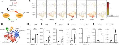 O-GlcNAc transferase regulates collagen deposition and fibrosis resolution in idiopathic pulmonary fibrosis